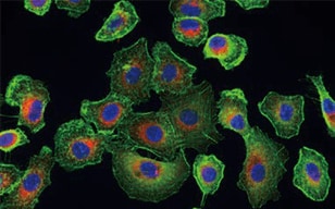 I型肺泡上皮癌细胞的多重染色观察