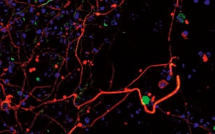 ES细胞向神经系统细胞分化