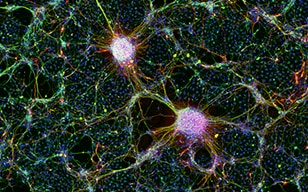 人iPS细胞衍生的神经细胞