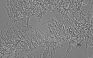 使用图像细胞分析仪（ICM）进行菌丝的浓度定量化