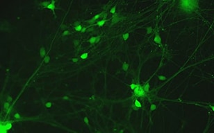 iPS细胞所衍生神经细胞的活动