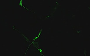 神经前体细胞（PC12）轴索伸长