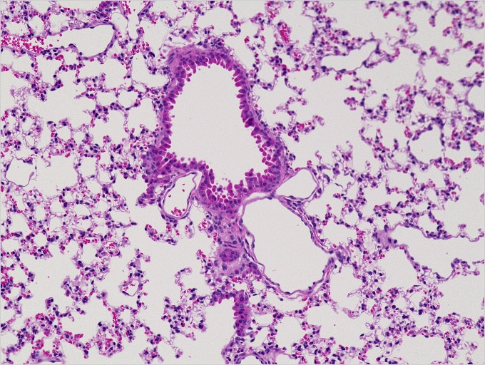 图片：小鼠的正常肺部（HE染色）……