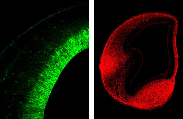 图片：左图为能够分化形成神经系统的神经干细胞……