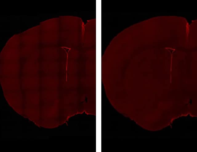 图片：成体小鼠室管膜细胞的染色图像……