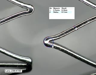 扩张导管支架支柱的HDR图像、曲率半径测量（150×）