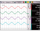 波形显示（横向滚屏）